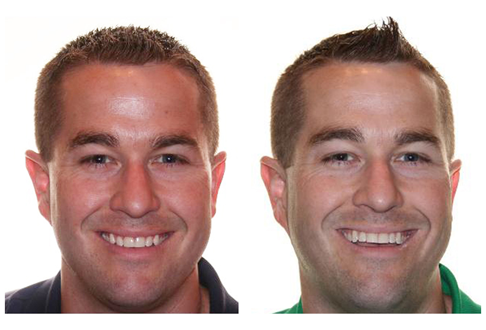 Fort Des Moines Dental