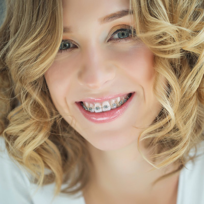 Fort Des Moines Dental | Crowns & Caps, Root Canals and Oral Exams