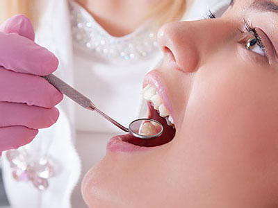 Fort Des Moines Dental | Periodontal Treatment, Dental Sealants and Fluoride Treatment